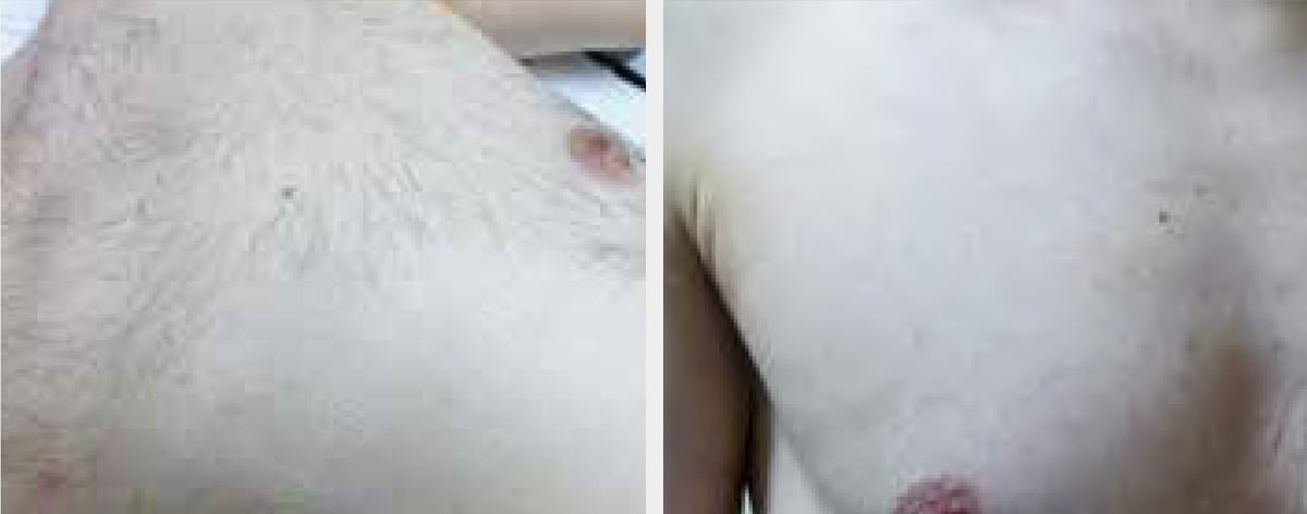 Before-After-Eneka-02